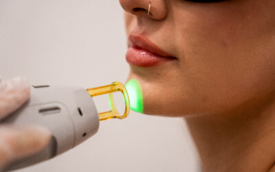 Treating Common Skin Concerns with Laser Therapy