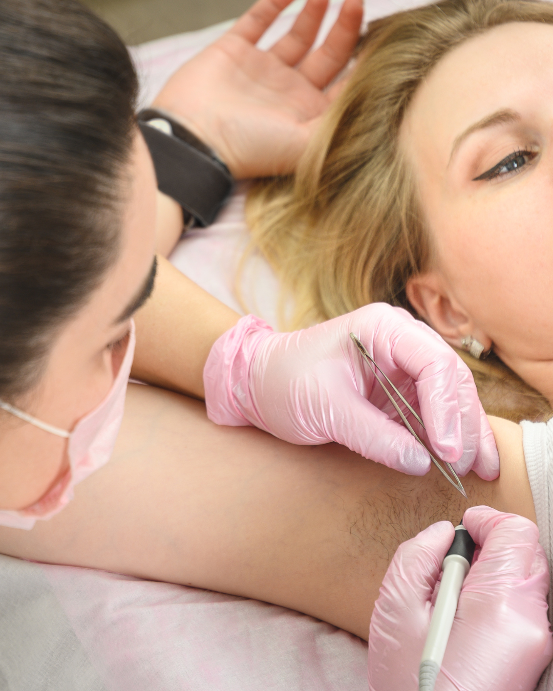 OMI CLINIC -5 Elektrolyse behandeling